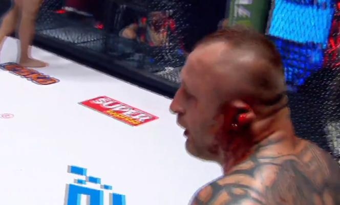 Lukasz Borowksi sufre escalofriante lesión: Amputación parcial de su oreja en medio de la pelea.
